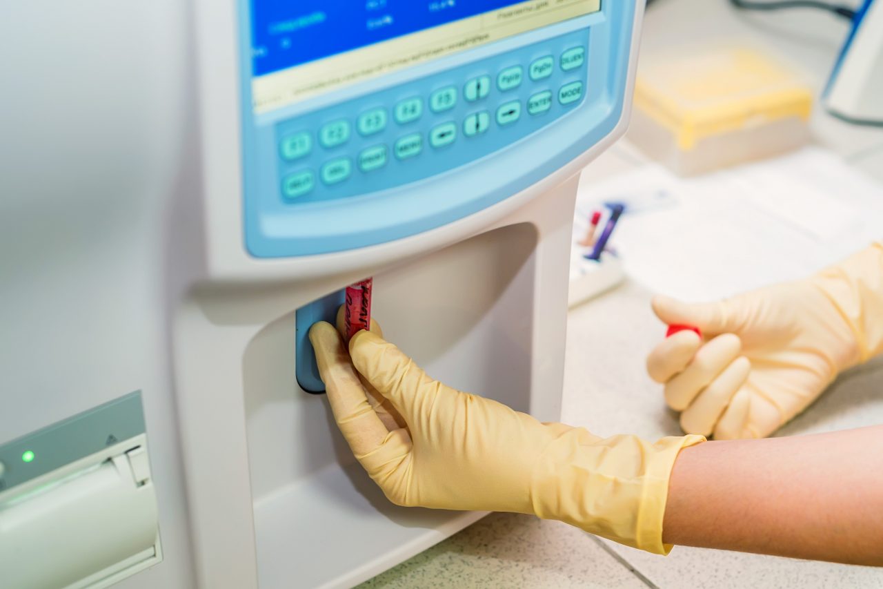 close-up-shot-of-electronic-chemical-analyzer-29WTSXQ-1280x853.jpg