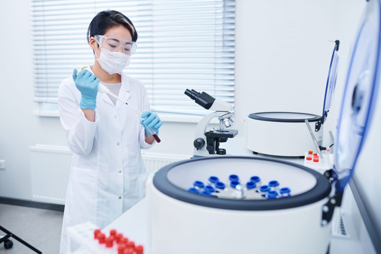 mixing-reagent-with-blood-sample-4R785AV-scaled-1280x854.jpg
