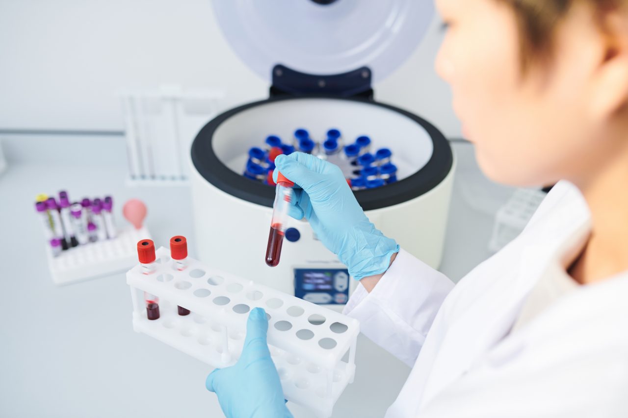 preparing-blood-samples-for-centrifuge-4GTNDRU-1280x853.jpg