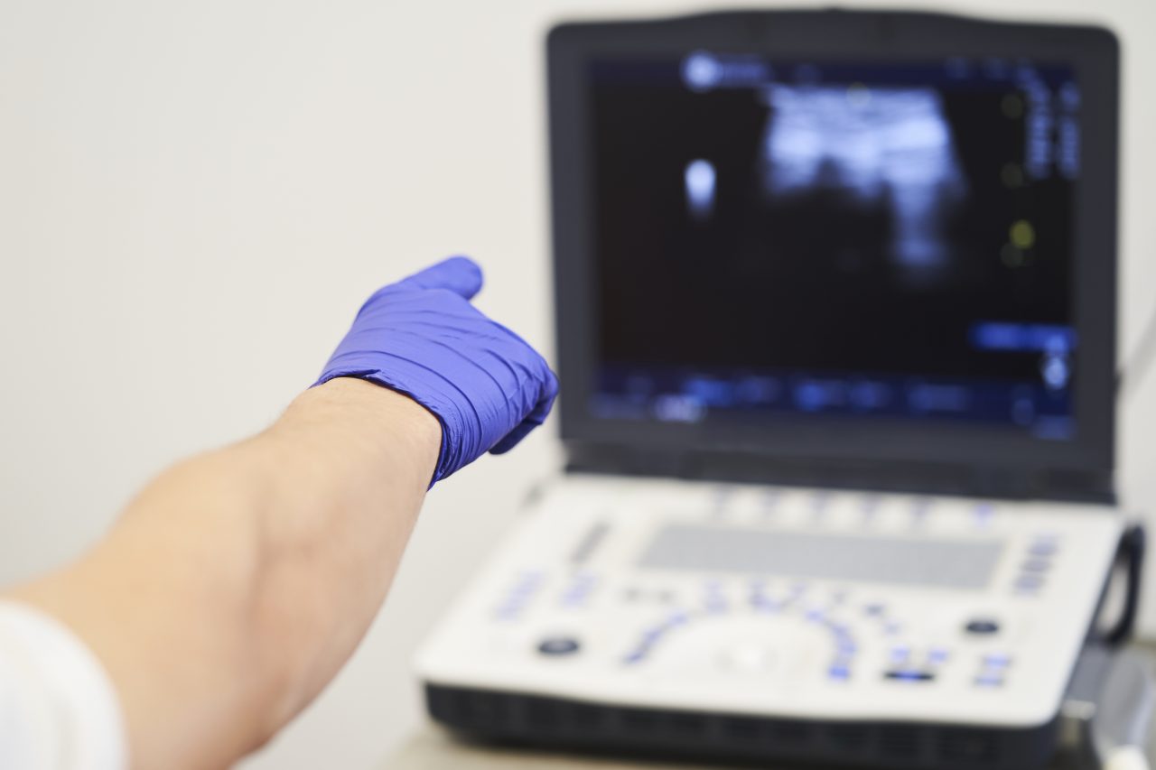 ultrasound-scan-at-the-fertility-clinic-doctor-po-2022-06-22-16-31-54-utc-1280x853.jpg